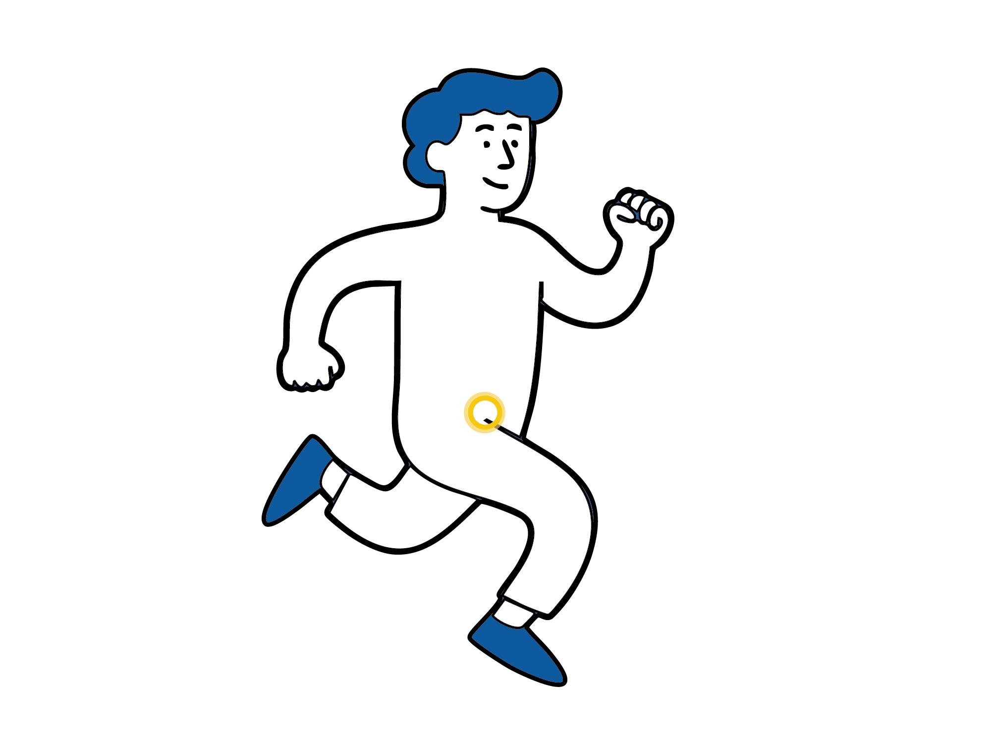 Medisinsk illustrasjon som viser at lyskebrokk kan være symptomfri og ikke merkes i hverdagen.