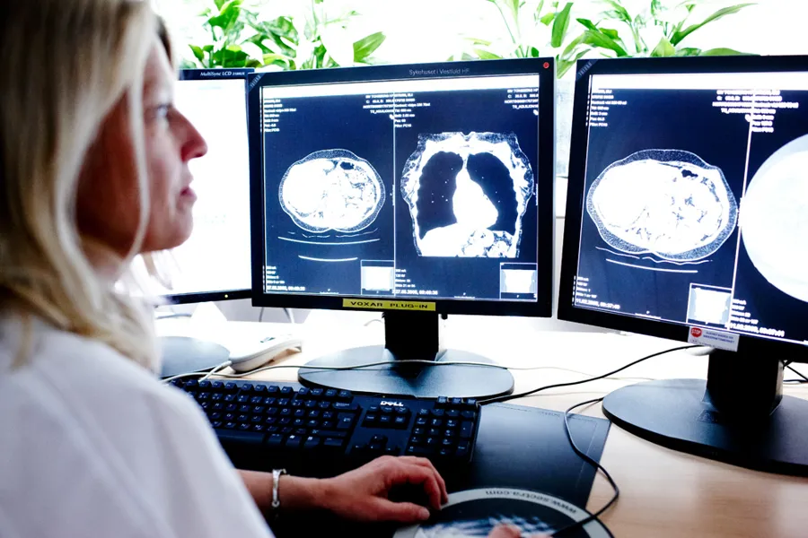 En kvinne ser på radiologiske bilder av en hjerne på en dataskjerm