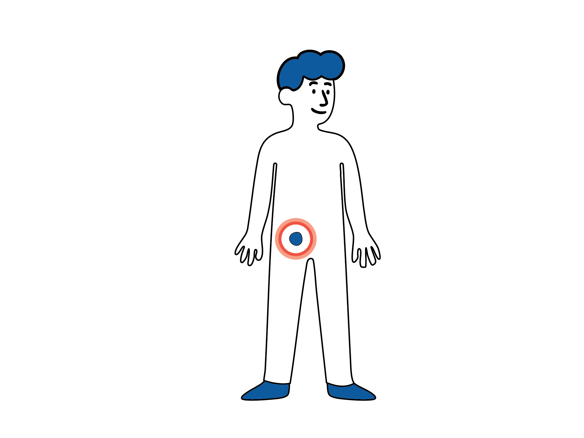 llustrasjon av en person sett forfra med en markering i lysken som viser området der lyskebrokk kan oppstå