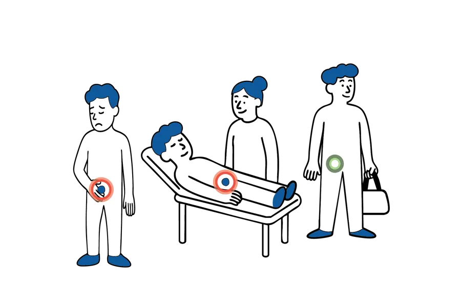 Medisinsk illustrasjon som viser forløpet ved dagkirurgisk behandling av lyskebrokk, fra innleggelse til hjemreise.