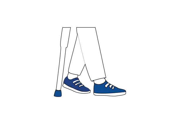 Illustrasjon som viser mobilisering etter operasjon, der pasienten går ved hjelp av krykker.