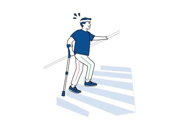 Illustrasjon som viser hvordan man går i trapper etter operasjon ved bruk av krykker og rekkverk.