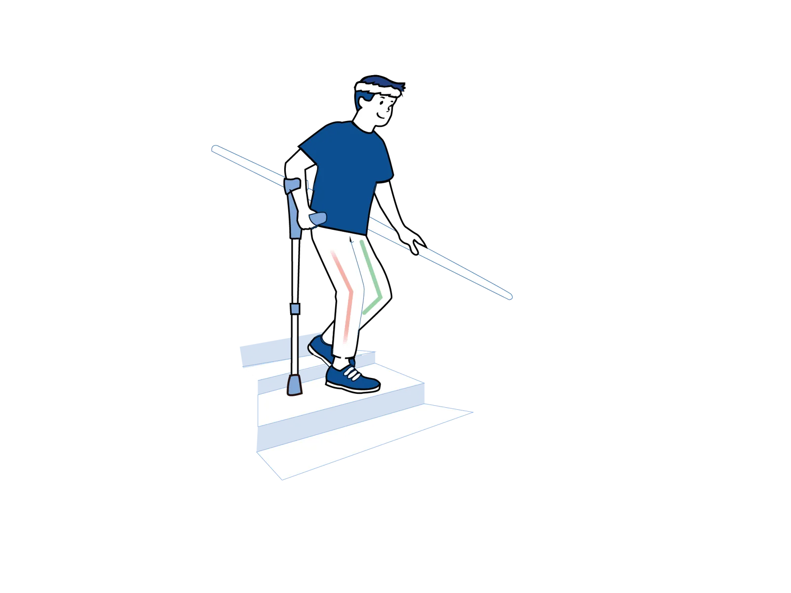 Illustrasjon som viser hvordan man går ned trapper etter operasjon ved bruk av krykker og rekkverk.