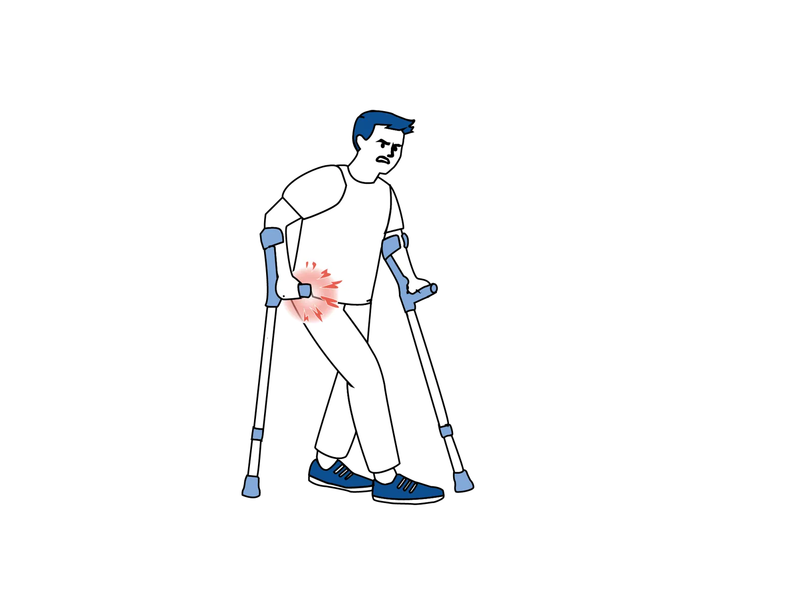 Illustrasjon som viser gang med krykker hjemme etter operasjon, med smerter eller ubehag i hoften.