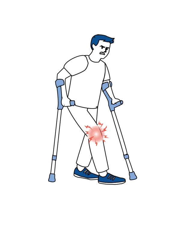 Illustrasjon som viser gang med krykker hjemme etter operasjon, med smerter eller ubehag i kneet.