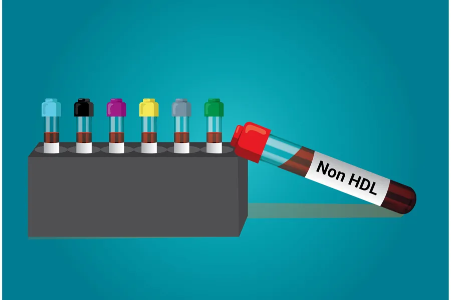 Illustrasjon av flere blodprøverør i et stativ og ett rør merket «Non‑HDL», som symboliserer analyse av non‑HDL‑kolesterol.