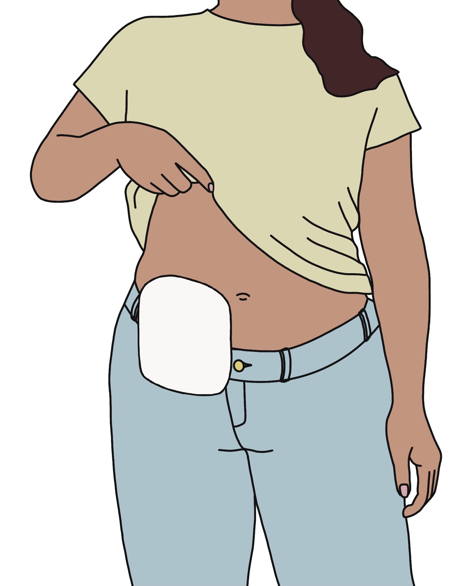 Tegning av kvinne med stomi