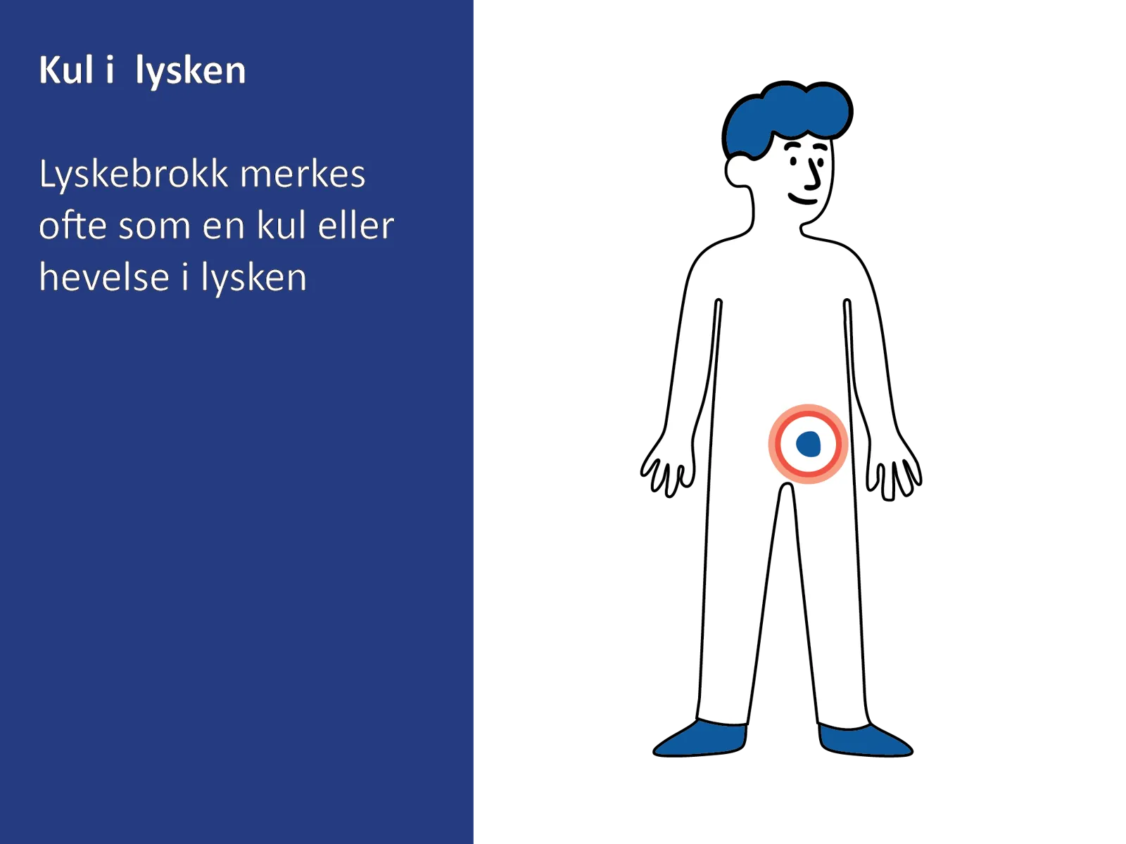 Illustrasjon som viser en kul i lysken på et menneske.