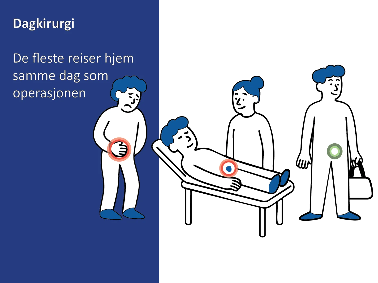 Medisinsk illustrasjon som viser forløpet ved dagkirurgisk behandling av lyskebrokk, fra innleggelse til hjemreise.