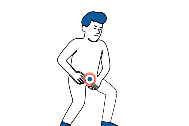 Medisinsk illustrasjon som viser at lyskebrokk gir smerter ved hosting, pressing eller tunge løft.