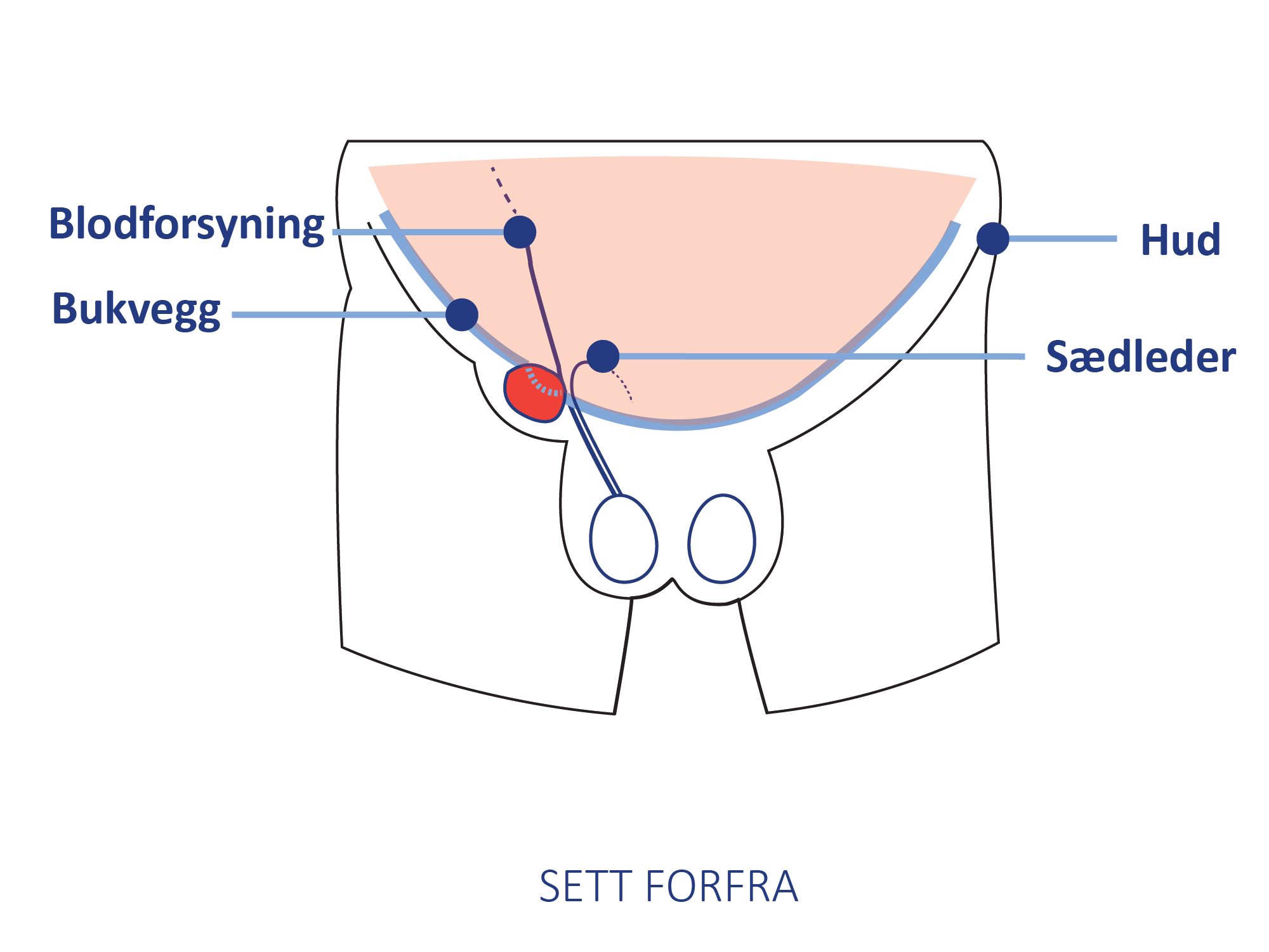 Anatomisk illustrasjon av lyskeområdet sett forfra, med markering av bukvegg, blodforsyning, sædleder og hud.