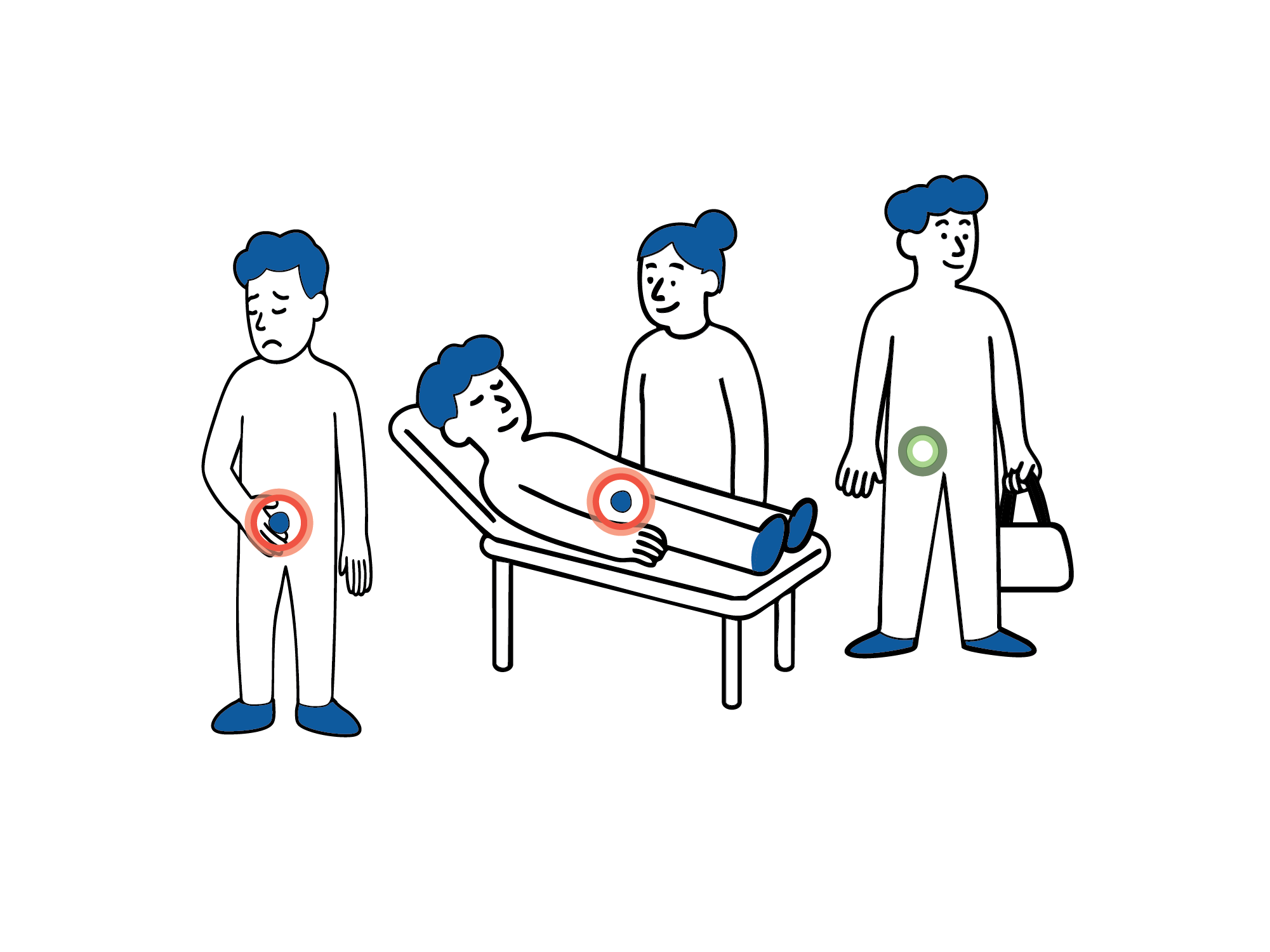 Medisinsk illustrasjon som viser forløpet ved dagkirurgisk behandling av lyskebrokk, fra innleggelse til hjemreise.