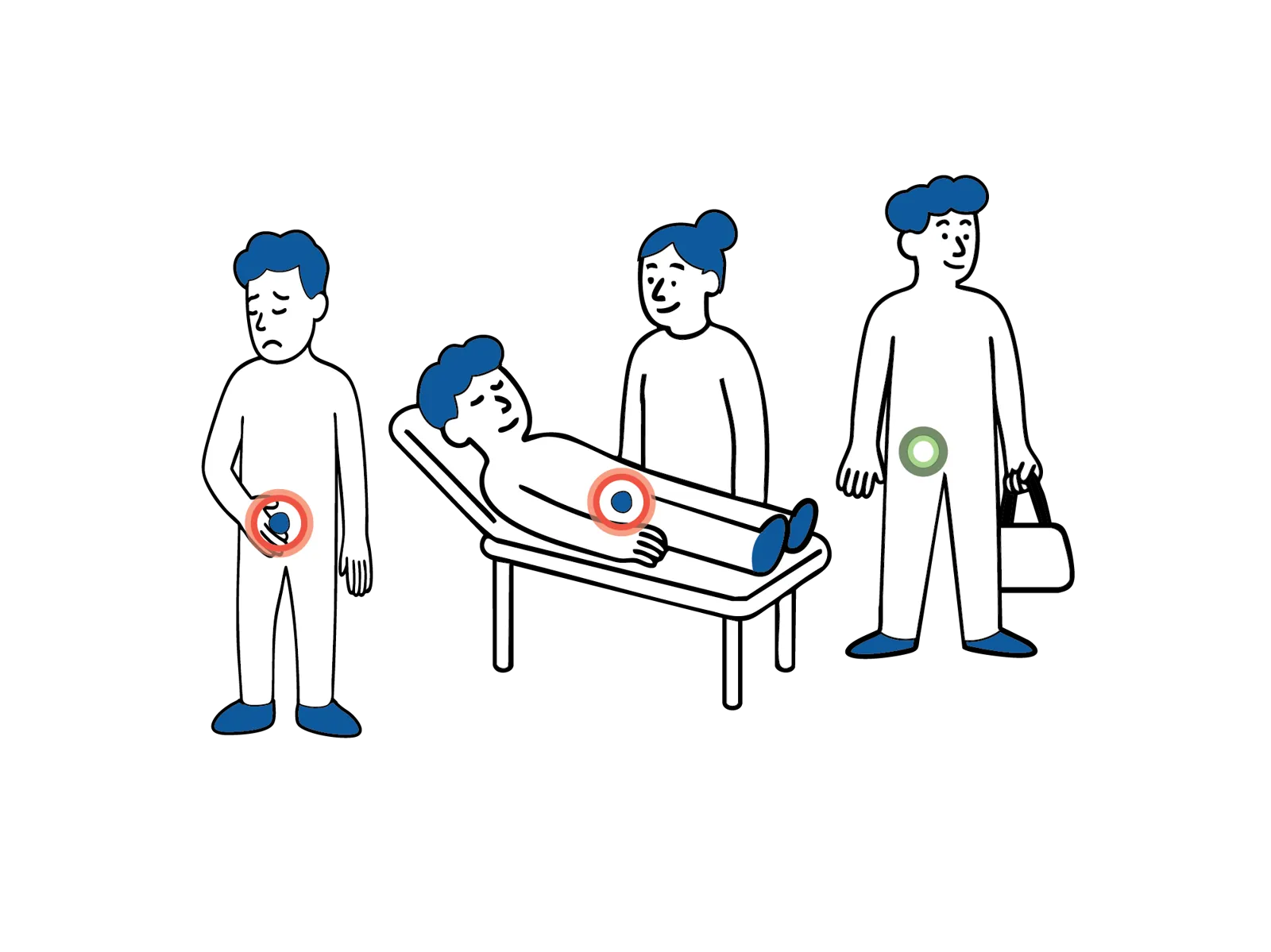 Medisinsk illustrasjon som viser forløpet ved dagkirurgisk behandling av lyskebrokk, fra innleggelse til hjemreise.