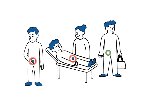 Medisinsk illustrasjon som viser forløpet ved dagkirurgisk behandling av lyskebrokk, fra innleggelse til hjemreise.