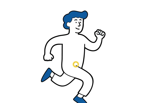 Medisinsk illustrasjon som viser at lyskebrokk kan være symptomfri og ikke merkes i hverdagen.