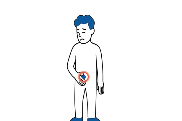 Illustrasjon som viser en kul i lysken på et menneske.