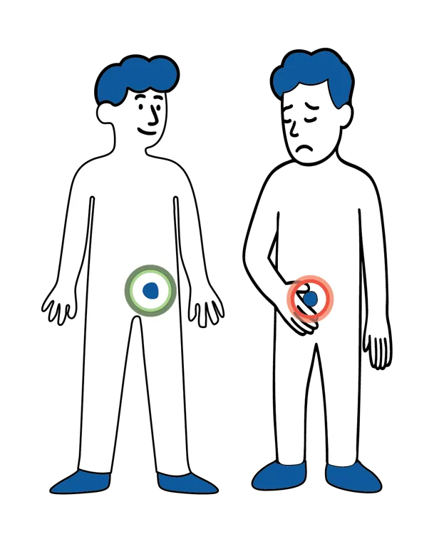 Illustrasjon av to personer, der den ene har normal grønn markering i lysken og den andre har rød markering og holder seg for området, som viser mulig komplikasjon.