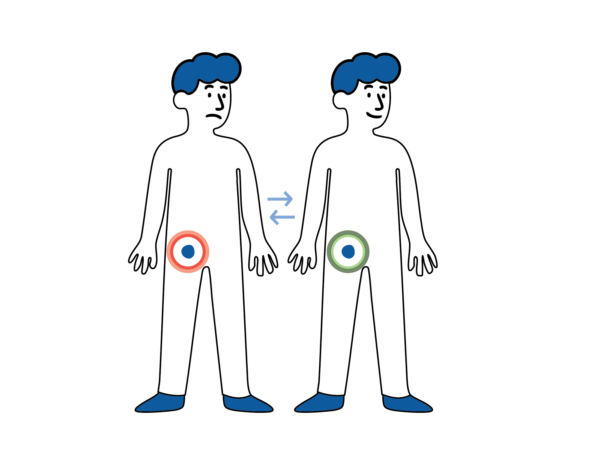 Illustrasjon av to personer, der én har rød markering rundt lysken som viser smerte og den andre har grønn markering som viser normalt område.