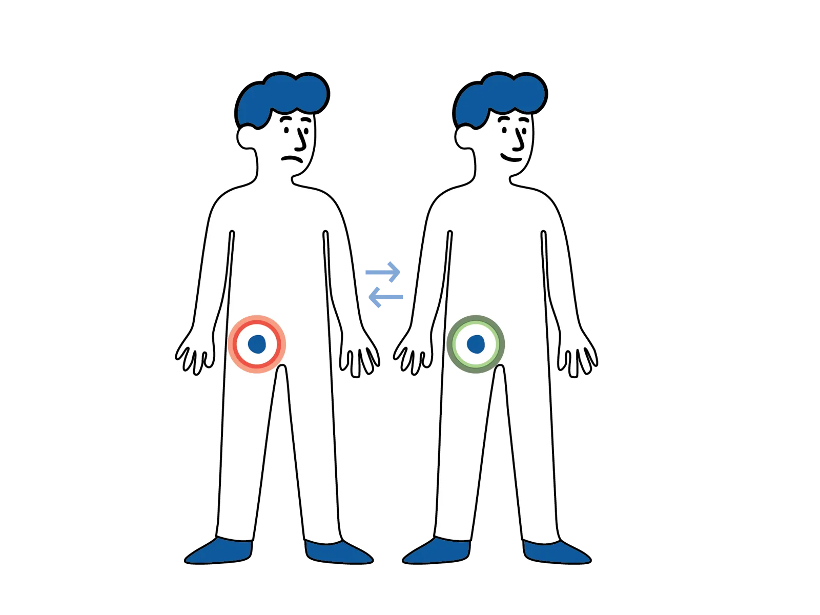Illustrasjon av to personer, der én har rød markering rundt lysken som viser smerte og den andre har grønn markering som viser normalt område.