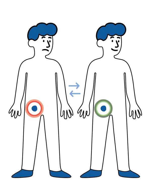 Illustrasjon av to personer, der én har rød markering rundt lysken som viser smerte og den andre har grønn markering som viser normalt område.